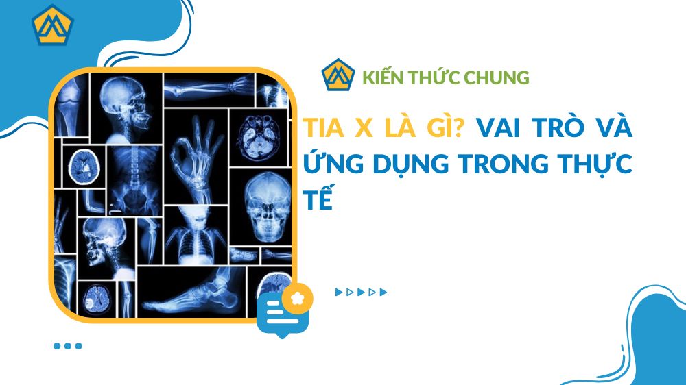 Tia X là gì? Vai trò và ứng dụng trong thực tế